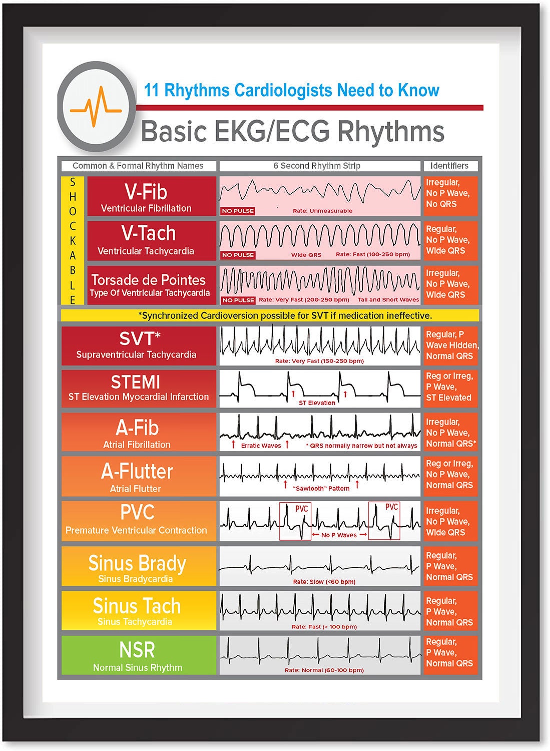 Cardiologist Basic EKG ECG Rhythms Poster Cardiologist Poster Decor ...