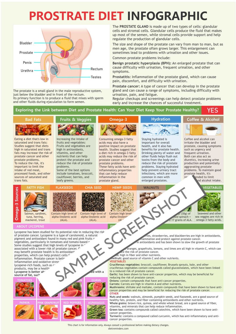 Prostate Infographic Chart, Digital Download PDF, Prostate Chart, Prostate Food, Prostadine