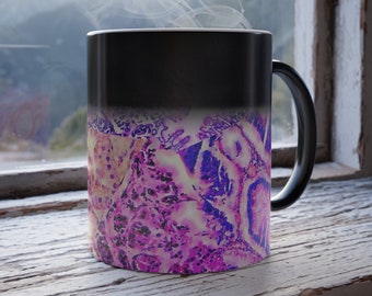 Histology Cytology Ophthalmology Color Morphing Mug, Women in Science Biology Lab Tech Immunology Physician Dr Mug Histotech Scientist Gift
