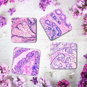 Pu&ograve; includere: Quattro sottobicchieri quadrati con un'immagine microscopica di cellule rosa e viola. I sottobicchieri sono su uno sfondo bianco con fiori viola.