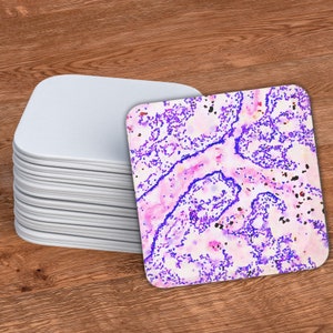 Pu&ograve; includere: Primo piano di un'immagine microscopica di un campione di tessuto. L'immagine mostra uno sfondo rosa e bianco con punti e linee viola.