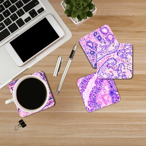 Pu&ograve; includere: Quattro sottobicchieri quadrati di colore rosa e viola con un'immagine microscopica di tessuto umano. I sottobicchieri hanno una finitura lucida.