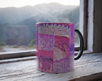 Skin Histology Color Morphing Mug: Medical Science Gift