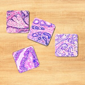 Pu&ograve; includere: Quattro sottobicchieri quadrati con diverse immagini microscopiche di campioni di tessuto. Le immagini sono in tonalit&agrave; di rosa e viola.
