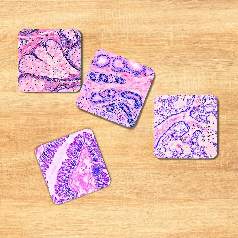 Pu&ograve; includere: Quattro sottobicchieri quadrati con diverse immagini microscopiche di campioni di tessuto. Le immagini sono in tonalit&agrave; di rosa e viola.