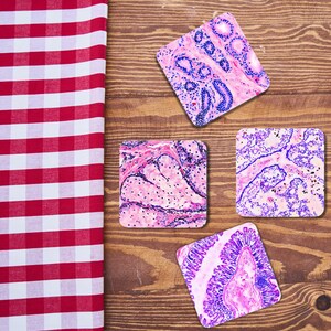 Pu&ograve; includere: Quattro sottobicchieri quadrati con immagini microscopiche di tessuto umano. I sottobicchieri sono rosa, viola e blu su sfondo bianco.
