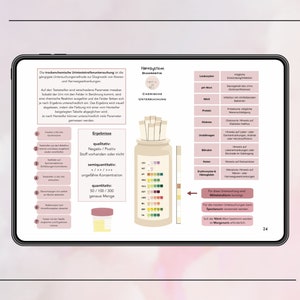 May include: A diagram illustrating a urine test strip with color-coded indicators for various substances, including leukocytes, protein, glucose, urobilinogen, bilirubin, ketones, and blood. The diagram also includes a description of the different substances and their potential significance in urine analysis.