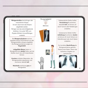 Puede incluir: Un diagrama que explica c&oacute;mo funcionan los rayos X y c&oacute;mo se utilizan para crear im&aacute;genes del cuerpo humano. El diagrama muestra una radiograf&iacute;a de una mano y una radiograf&iacute;a de t&oacute;rax. El texto explica que los objetos densos como los huesos aparecen blancos en una radiograf&iacute;a, mientras que los espacios llenos de aire aparecen negros.