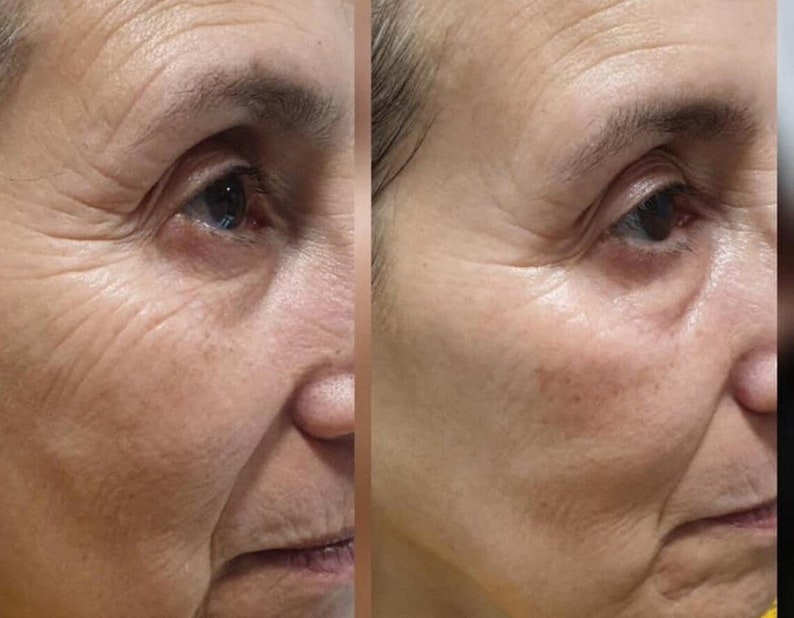 Galvanic Spa Face Care Essentials KIT Ageloc 4 Heads Facial Gels Etsy