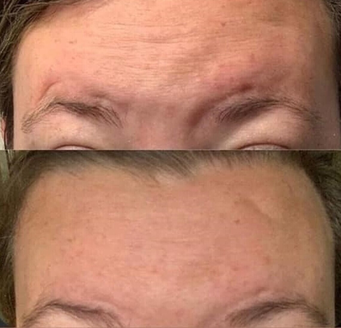 Galvanic Spa Face Care Essentials KIT Ageloc 4 Heads Facial Gels Etsy