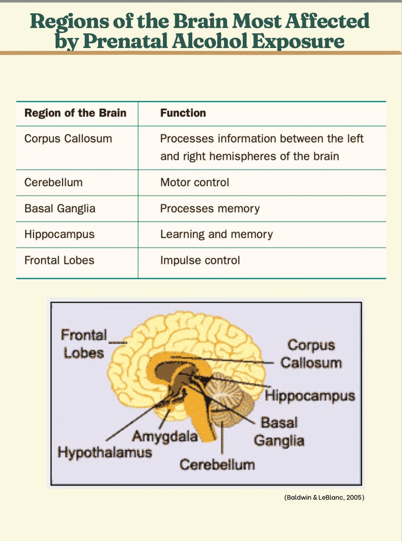 Fetal Alcohol Syndrome Guide Etsy