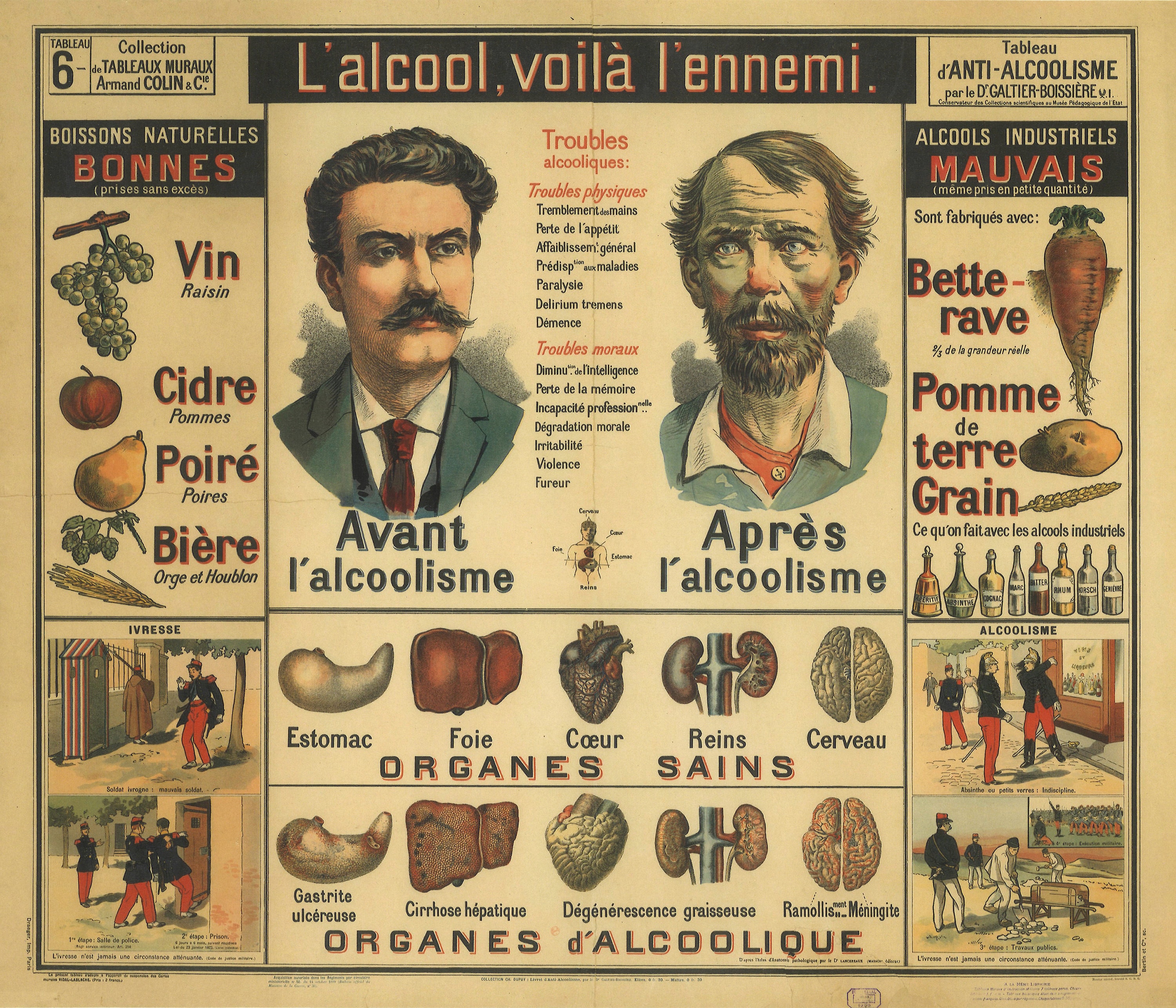 Poster anatomie -  France