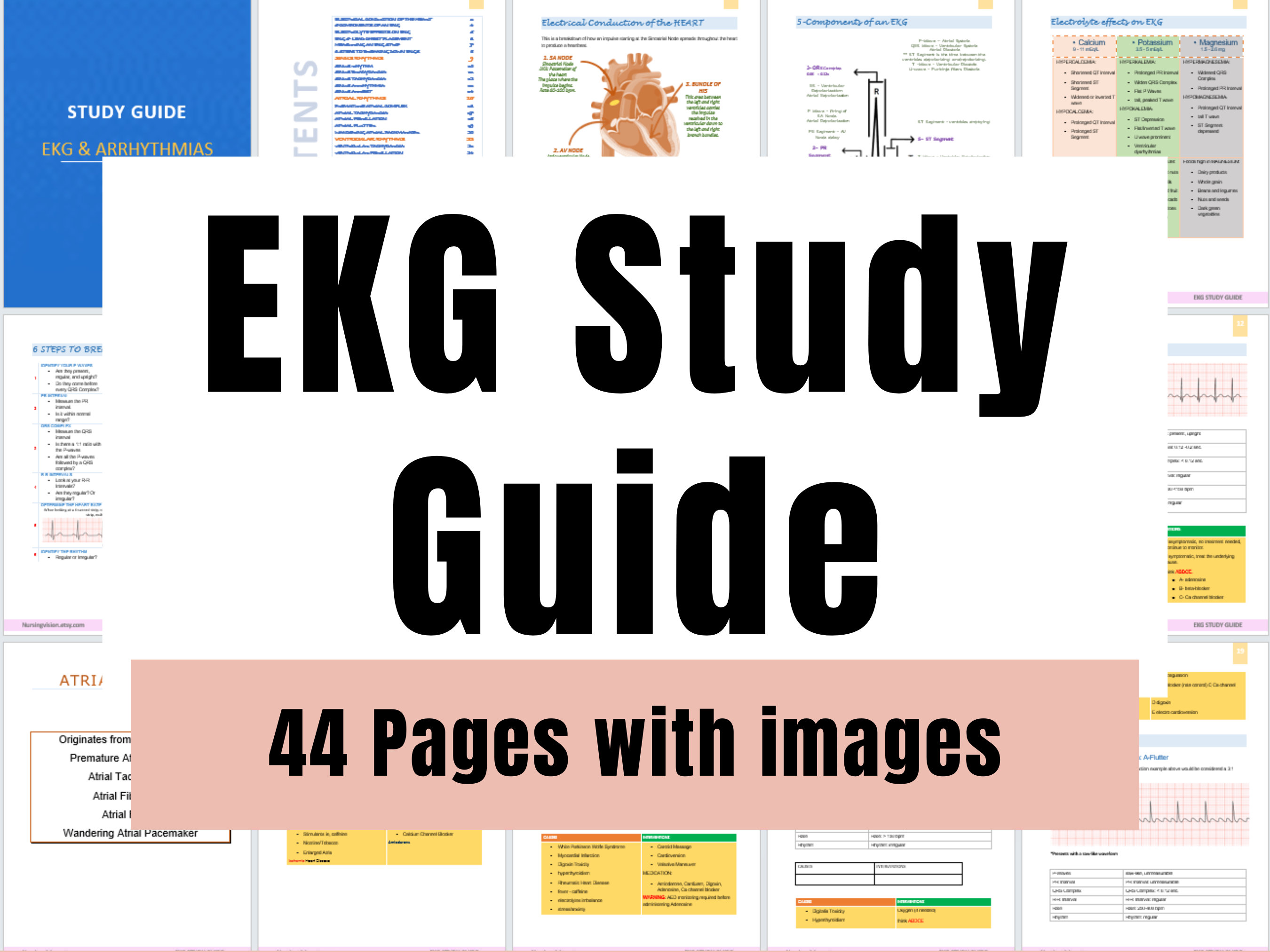 EKG Study Guide: Nursing School EKG Interpretations (44 Pages) - Etsy