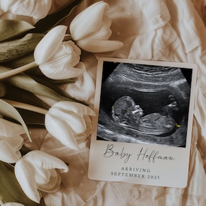 Floral Digital Pregnancy Announcement Template | Baby announcement | Ultrasound Gender Neutral, Editable | Announcement for social media