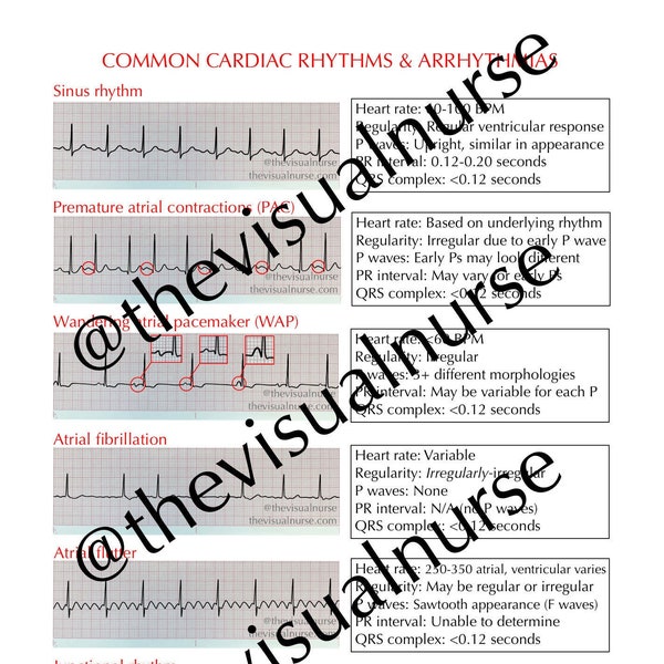 Common Cardiac Rhythms and Arrhythmias - PDF instant download