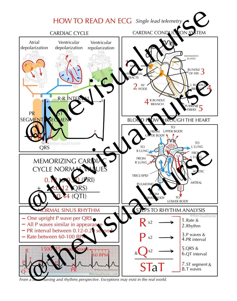 How to Read an ECG Single Lead Telemetry PDF Instant Download Etsy