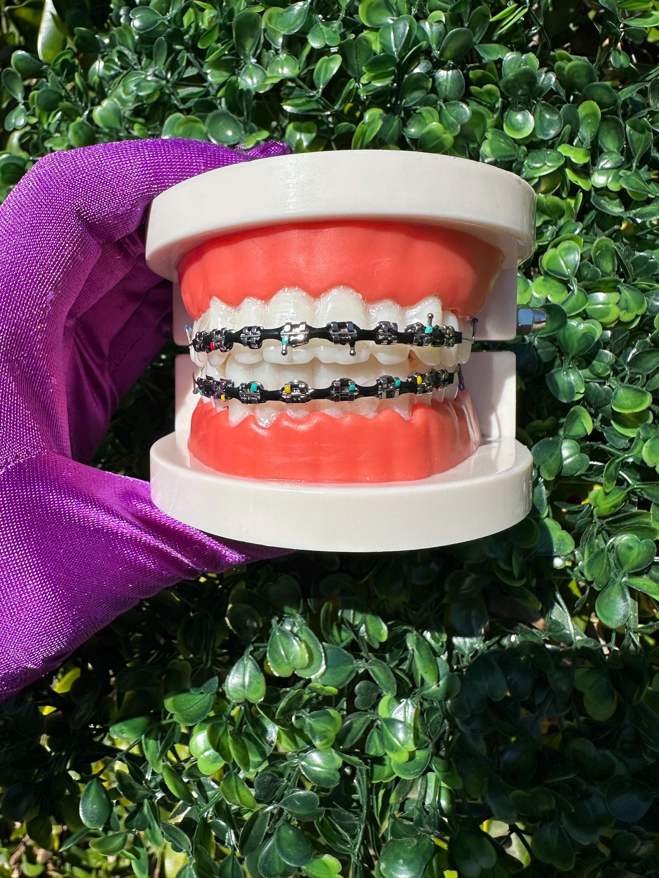 CUTE preteen BRACES FOOT 