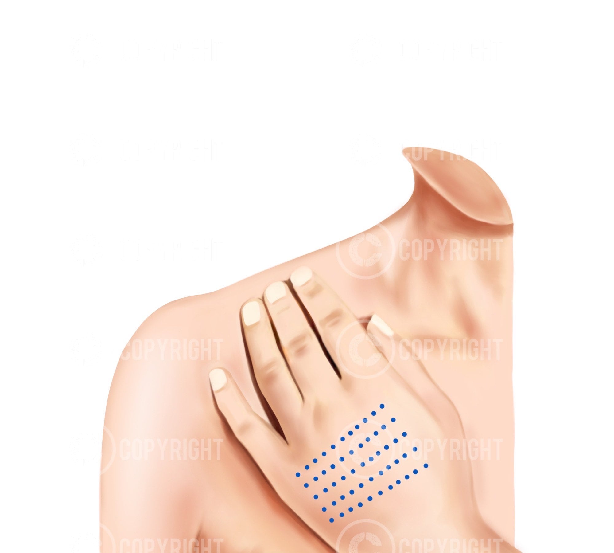 Botox Injecton Pattern For Men Mesotherapy Injection Patterns | Botox & Filler Injector | Anatomy ...