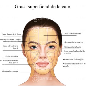 Peut inclure: Diagramme d'un visage féminin montrant les différentes zones de graisse sous-cutanée, étiquetées en espagnol. Les zones comprennent le front, les joues, le menton et la mâchoire.