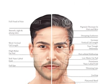 Pacote | Envelhecimento Masculino da Face e Pescoço | Injetor de Botox e Preenchimento | Anatomia | Daniel | Estética | Esteticista | Download digital