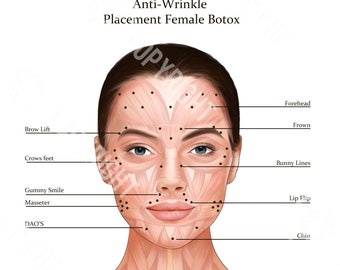 Botox Injection Points on Muscle Anatomy | Botox & Filler Injector | Anatomy | Esthetician | Dermatology | Medspa| Digital Download