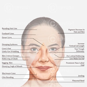 Bündel | Alterung von Gesicht und Hals | Botox- und Filler-Injektor | Anatomie | Medspa | Kosmetikerin | Dermatologie | Medspa| Digitaler Download