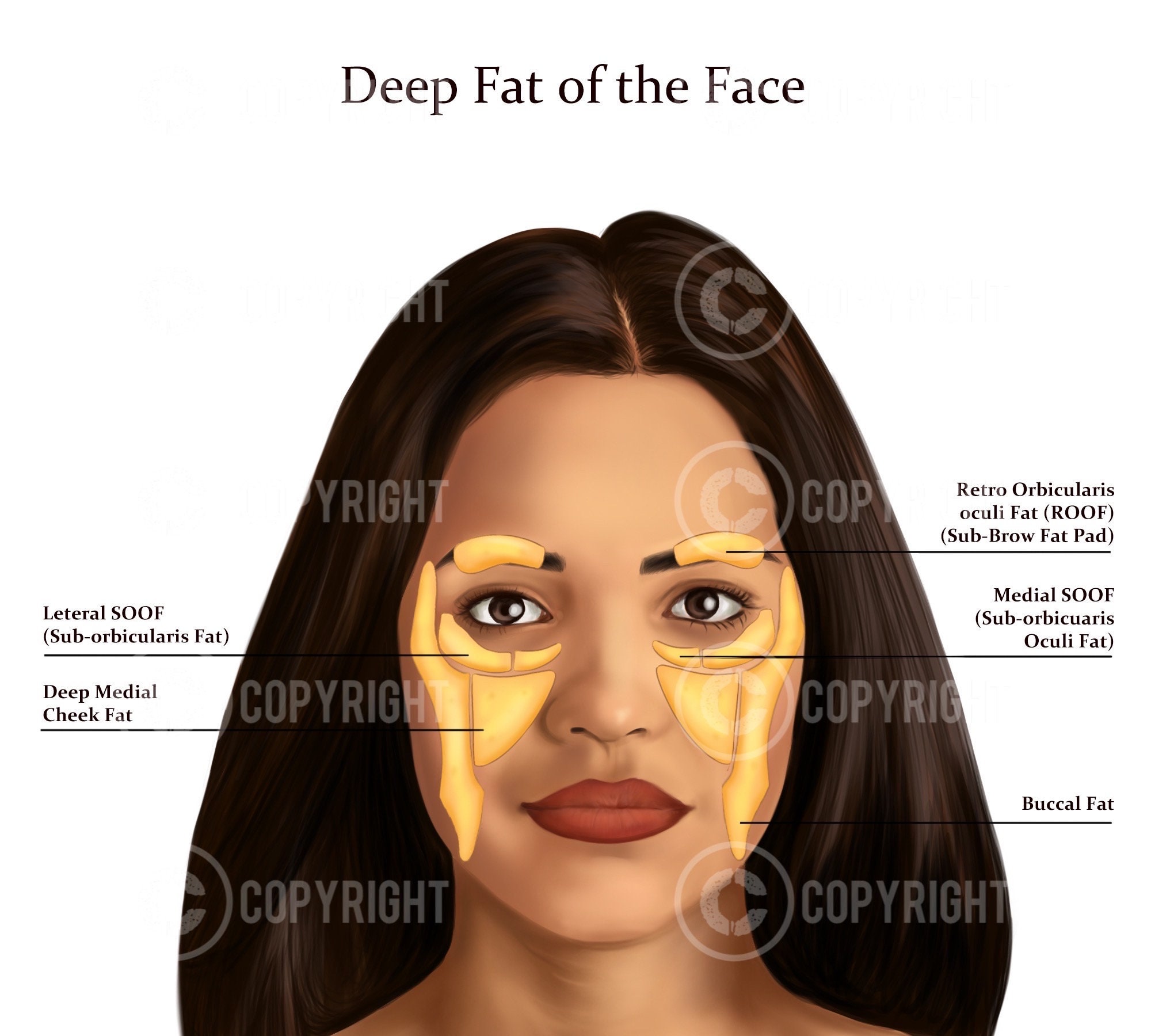 Deep Fat Pads the Face Botox & Filler Injector Anatomy Art Esthetician ...