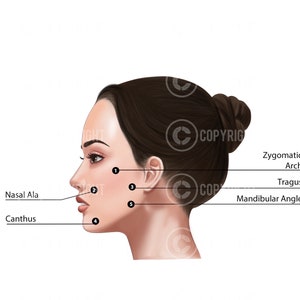 Profhilo 5 point BAP Face Illustration Only|  SKin Boosters | Injector | Anatomy | Aesthetics | Dermatology | Medspa| Digital Download