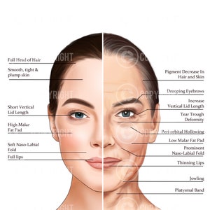 Ageing of the Face and Neck | Botox & Filler Injector | Anatomy | Esthetician | Aesthetics | Dermatology | Medspa| Digital Download