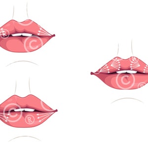 Russian Lip Filler injection Techniques | Dermal Filler | Illustrations | Injector | Esthetician | Dermatology | Medspa | Digital Download