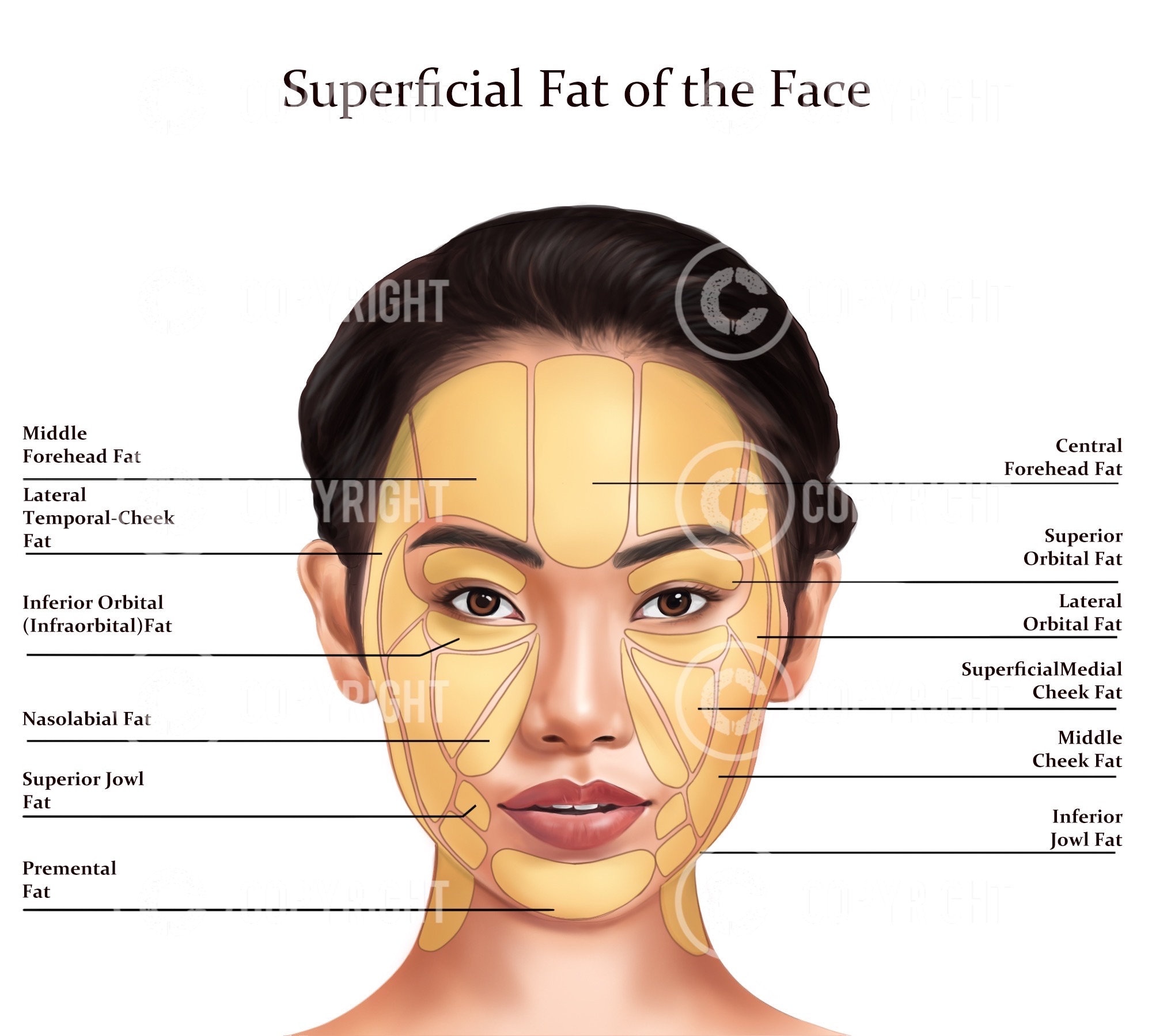 Superficial Fat Pads of the Face Botox Filler Injector Anatomy Art