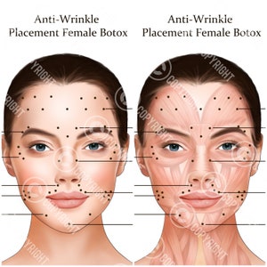 Botox Injection Points Bundle | Botox & Filler Injector | Anatomy | Art | Esthetician | Aesthetics | Dermatology | Medspa| Digital Download