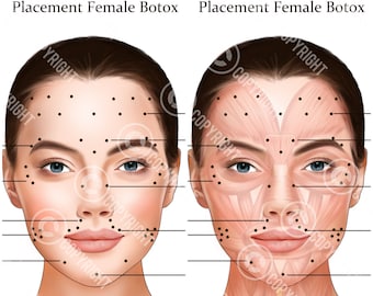 Botox Injection Points Bundle | Botox & Filler Injector | Anatomy | Art | Esthetician | Aesthetics | Dermatology | Medspa| Digital Download