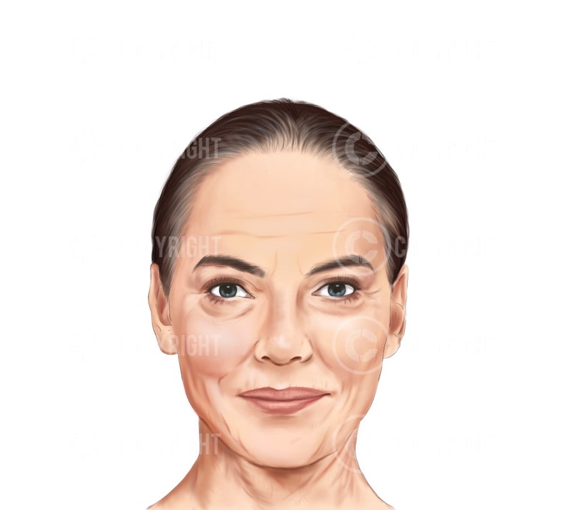 Ageing of the Face and Neck Botox & Filler Injector Etsy