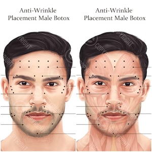 Male BOTOX Injection Points Bundle | Botox & Filler Injector | Anatomy | Aesthetics | Dermatology | Medspa  | Esthetician | Digital Download