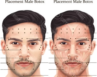 Male BOTOX Injection Points Bundle | Botox & Filler Injector | Anatomy | Aesthetics | Dermatology | Medspa  | Esthetician | Digital Download