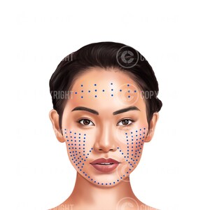 Mesotherapy injection patterns | Botox & Filler Injector | Anatomy | Esthetician | Aesthetics | Dermatology | Medspa| Digital Download