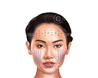 Botox Injection Points on Muscle Anatomy PNG| Botox & Filler Injector ...