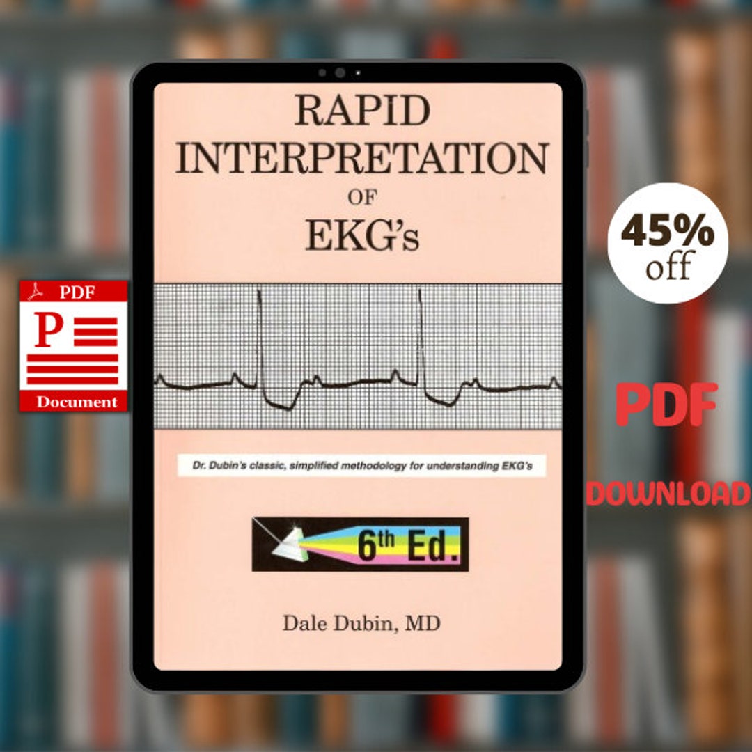 Rapid Interpretation of Ekg's Sixth Edition Etsy