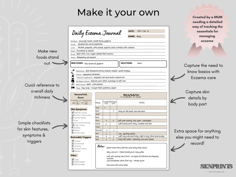May include: A printable daily eczema journal with sections for tracking food, symptoms, triggers, and skin condition by body part. The journal is designed to help manage eczema.