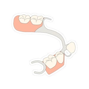 May include: A sticker featuring a dental partial denture. The illustration shows a set of artificial teeth attached to a pink gum-colored base, with silver clasps and a connecting bar.