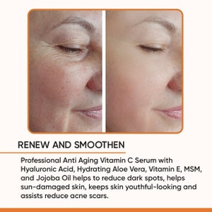 May include: Side-by-side comparison of a woman's face, showing before and after effects. The left side displays wrinkles and uneven skin tone, while the right side shows smoother, more even skin. Text reads "RENEW AND SMOOTHEN".