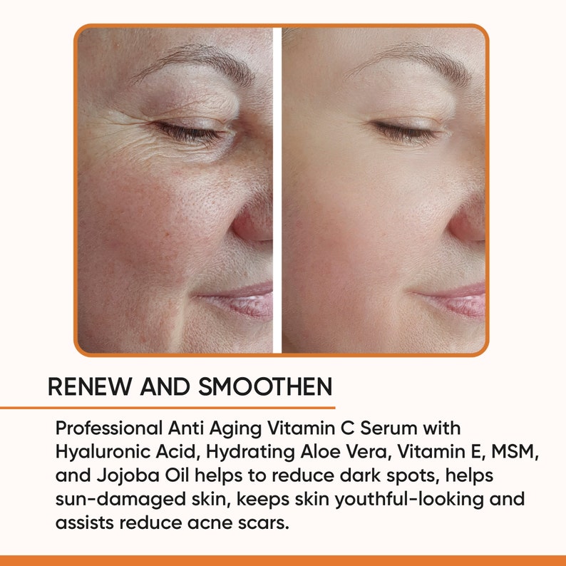 May include: Side-by-side comparison of a woman's face, showing before and after effects. The left side displays wrinkles and uneven skin tone, while the right side shows smoother, more even skin. Text reads "RENEW AND SMOOTHEN".