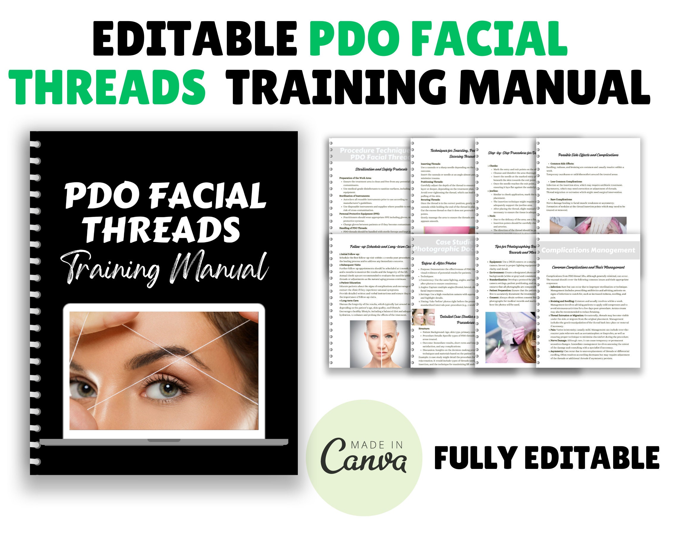 PDO Facial Threads Training Manual, Beginners Thread Lifts, PDO ...