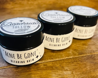 ACNE BE GONE-1 oz Organic Acne Tallow Balm- Acne Clearing, Beef Tallow Balm, Small Batch Salve with Blue Tansy Oil