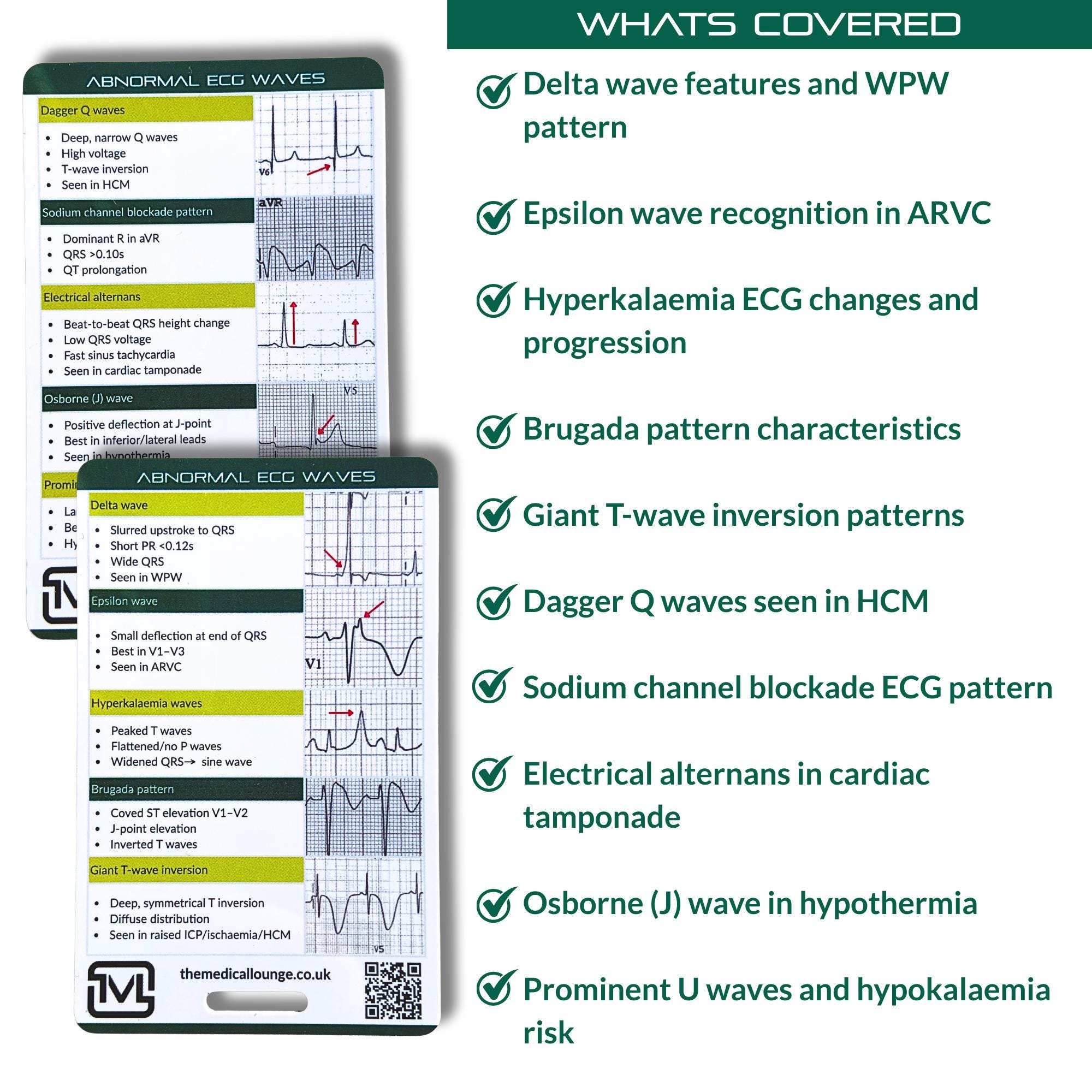 Abnormal Ecg Waves Reference Card | Ecg Study & Revision Aid for ...