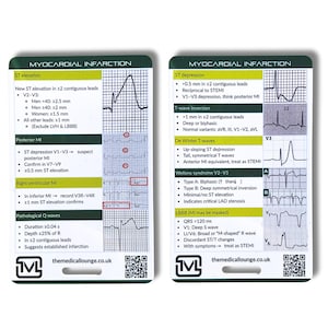 Cartão de referência de ECG para infarto do miocárdio (IAMCSST)