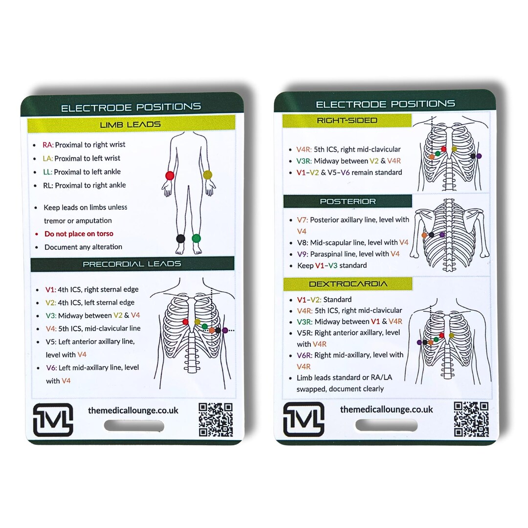 Ecg Electrode Positions Reference Card | Limb & Chest Lead Placement ...