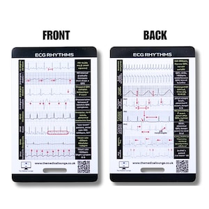Cartão de Referência de Ritmo de ECG | 15 Tiras de ECG Anormais com Guia Visual e Critérios | Cartão de Bolso para Paramédicos, Enfermeiros e Estudantes