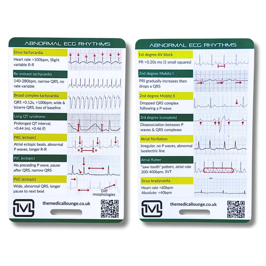 Abnormal Ecg Rhythms – Interpretation Reference Card - Etsy